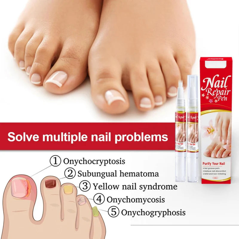Nail Repair Pen
